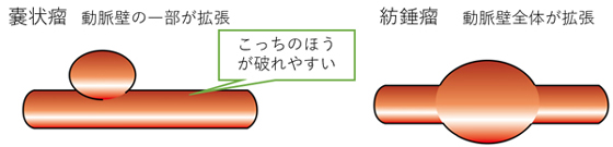 形態による分類