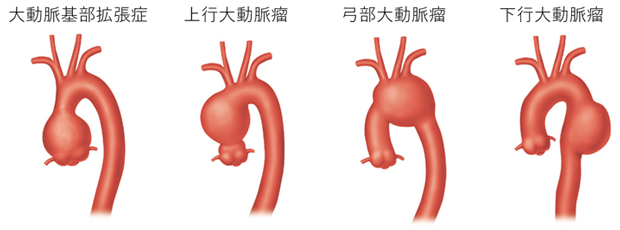 部位による分類