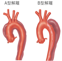 3.解離した場所によって、危険性が違う