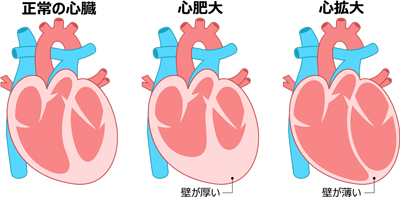 初期（代償期）