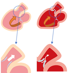 原因のほとんどは加齢