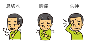 1.大動脈弁狭窄症の症状