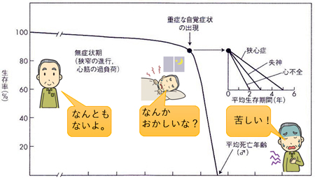 1.大動脈弁狭窄症の症状
