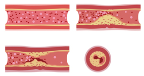心臓へのエネルギー供給路
