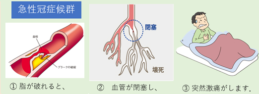 心臓へのエネルギー供給路
