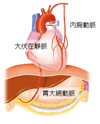 どのような血管が使用されますか？
