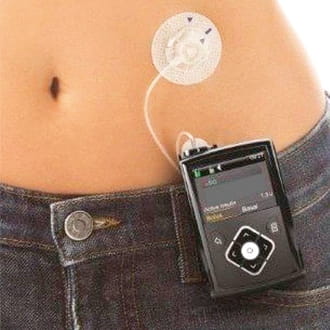 インスリンポンプ