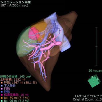 術中シミュレーション