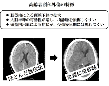 高齢者頭部外傷
