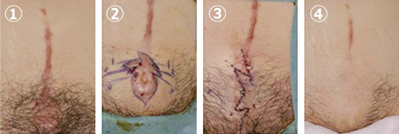 傷あとセンター